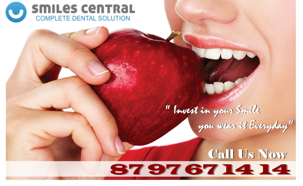 Learn Exactly How I Improved veneers transformation In 2 Days Are You veneers transformation The Right Way? These 5 Tips Will Help You Answer